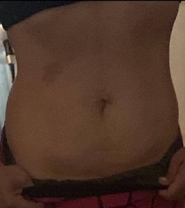 After treatment image